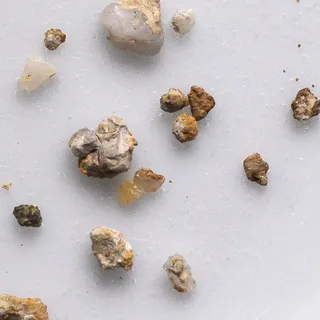 0,7 % = 1,0 mm